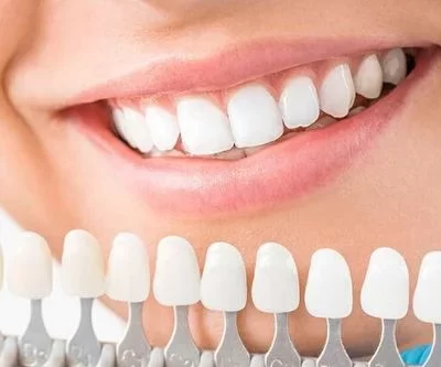 Cosmetic Dentist at Kranti Dental Care in Aurangabad