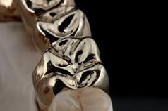 Metal Dental Crown at Kranti Dental Care in Aurangabad