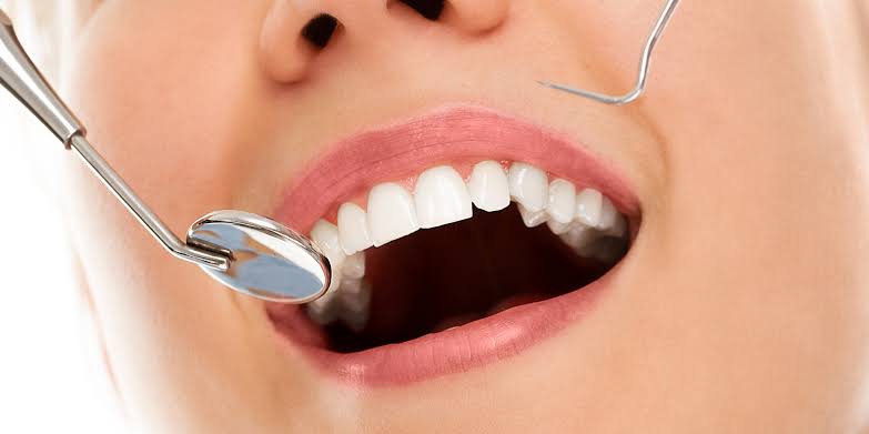 teeth cleaning harmful myth India Kranti Dental Care Aurangabad